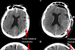 Read more about the article ജീവിതത്തില്‍ അതുവരെ നടന്ന പ്രധാന സംഭവങ്ങളെല്ലാം മനസ്സില്‍ മിന്നിമറയും; മരണത്തിന് തൊട്ട് മുമ്പ് സംഭവിക്കുന്നത്