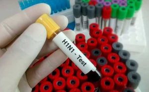 Read more about the article കാസർകോട്  ജില്ലയില്‍ എച്ച് വണ്‍ എന്‍ വണ്‍ സ്ഥിരീകരിച്ചു;  ജാഗ്രത പാലിക്കണം:ഡി. എം. ഒ