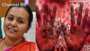 Read more about the article കുരങ്ങുവസൂരി ബാധ; സംസ്ഥാനത്ത് കൂടുതല്‍ സ്ഥിരീകരിച്ചേക്കാം എന്ന് മന്ത്രി വീണാ ജോര്‍ജ്, എല്ലാ ജില്ലകളിലും ഐസൊലേഷന്‍ സൗകര്യം, എല്ലാ ജില്ലകളിലും ഐസൊലേഷന്‍ സൗകര്യം