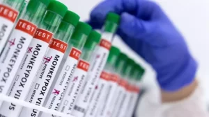 Read more about the article മങ്കി പോക്സ് കേരളത്തിലും? യുഎഇയിൽനിന്ന് വന്നയാൾ നിരീക്ഷണത്തിലെന്ന് ആരോഗ്യമന്ത്രി