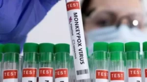 Read more about the article മങ്കിപോക്സ്; കോട്ടയത്ത് 2 പേർ നിരീക്ഷണത്തിൽ