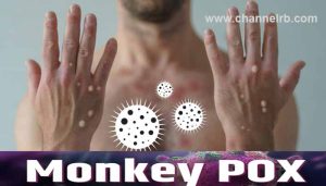 Read more about the article കേരളത്തിൽ ഒരാൾക്ക് കൂടി മങ്കിപോക്‌സ് സ്ഥിരീകരിച്ചു; രോഗം സ്ഥിരീകരിച്ചത് അഞ്ചുപേർക്ക്,  യു.എ.ഇയില്‍ നിന്നാണ് ഇയാൾ കോഴിക്കോട് എയര്‍പോര്‍ട്ടില്‍ എത്തിയത്