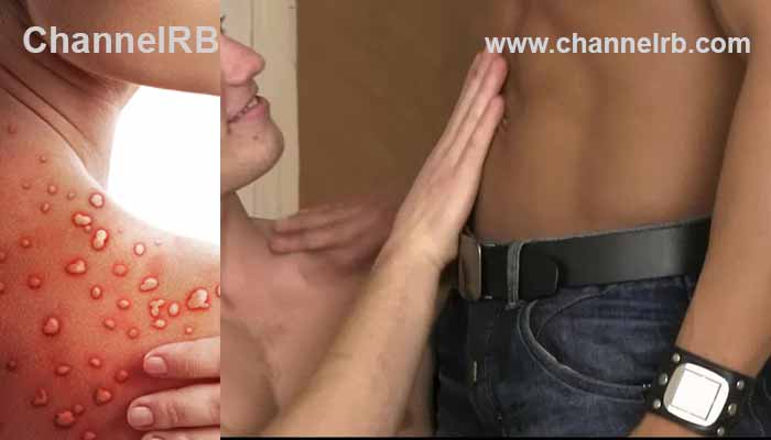 Read more about the article സമൂഹം കുറ്റപ്പെടുത്തുമെന്ന് ഭയം; മങ്കിപോക്സ് ടെസ്റ്റ് നടത്താന്‍ സ്വവര്‍ഗ അനുരാഗികള്‍ മടിക്കുന്നു