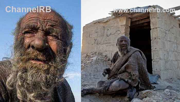 Read more about the article കുളിച്ചാല്‍ അസുഖം വരുമെന്ന് ഭയം; കൈ കഴുകിയിട്ട് തന്നെ 50 വര്‍ഷം കഴിഞ്ഞു, ലോകത്തെ വൃത്തിയില്ലാത്ത മനുഷ്യന്‍ മരിച്ചു