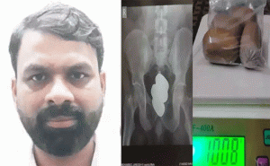 Read more about the article മലദ്വാരത്തില്‍ ഒളിപ്പിച്ച് കടത്താന്‍ ശ്രമം; കരിപ്പൂർ വിമാനത്താവളത്തിൽ  ഒരു കിലോയിലധികം സ്വര്‍ണം പിടികൂടി