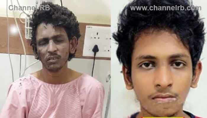 You are currently viewing സ്ഫോടന കേസില്‍ പരിക്കേറ്റത് പ്രതി ഷാരിക്കിന് തന്നെ; മംഗളൂരിൽ ബന്ധുക്കൾ തിരിച്ചറിഞ്ഞു