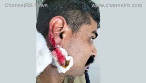 Read more about the article എസ്‌.ഐയുടെ ചെവി കടിച്ചുപറിച്ച പ്രതി റിമാണ്ടിൽ; ചെവി പ്ലാസ്‌റ്റിക്ക്‌ സർജറിക്ക്‌ വിധേയമാക്കി