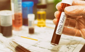 Read more about the article എച്ച് 3 എന്‍ 2 വൈറസ്; രാജ്യത്ത് ആദ്യ മരണം കര്‍ണാടകയില്‍; ചികിത്സ- പ്രതിരോധം എന്നിവ അറിയാം