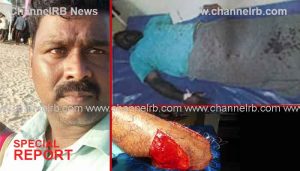 Read more about the article രാത്രി ഗൃഹപ്രവേശന സൽക്കാരത്തിന് ഇടയിൽ സംഘർഷം; ബാങ്ക് ജീവനക്കാരനും ഡ്രൈവർക്കും പരിക്കേറ്റു, പോലീസ് രണ്ട് കേസെടുത്തു