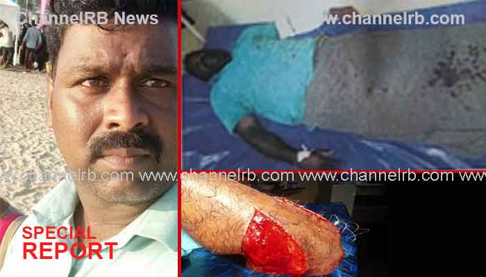 You are currently viewing രാത്രി ഗൃഹപ്രവേശന സൽക്കാരത്തിന് ഇടയിൽ സംഘർഷം; ബാങ്ക് ജീവനക്കാരനും ഡ്രൈവർക്കും പരിക്കേറ്റു, പോലീസ് രണ്ട് കേസെടുത്തു