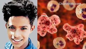Read more about the article തലച്ചോറിനെ കാർന്നു തിന്നുന്ന ബ്രെയിൻ ഈറ്റിങ് അമീബിയ; രോഗം ബാധിച്ച പതിനഞ്ചുകാരന്‍ മരിച്ചു, രോഗം ബാധിച്ചത് തോട്ടില്‍ കുളിക്കുമ്പോഴെന്ന് സൂചന
