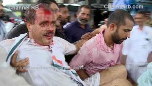 Read more about the article ഡി.സി.സി പ്രസിഡണ്ടിന് എതിരായ പൊലീസ് അക്രമത്തില്‍ വ്യാപക പ്രതിഷേധം, ഒരു മുന്നറിയിപ്പില്ലാതെ ആണ് മര്‍ദ്ദനമെന്നും രാജ്‌മോഹന്‍ ഉണ്ണിത്താന്‍ എം.പി