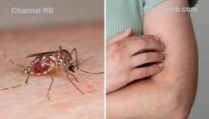 Read more about the article കൊതുക് ചിലരെ മാത്രം കടിക്കുന്നു; ഈ കാരണങ്ങളാൽ കൊതുക് ഇരയെ കണ്ടെത്തും