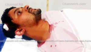 Read more about the article ഗുണ്ടാസംഘങ്ങള്‍ ഉപ്പളയില്‍ വീണ്ടും പിടിമുറുക്കി; യുവാവിനെ പത്തംഗ സംഘം കല്ലുകൊണ്ട് തലക്കടിച്ച് പരിക്കേല്‍പ്പിച്ചു