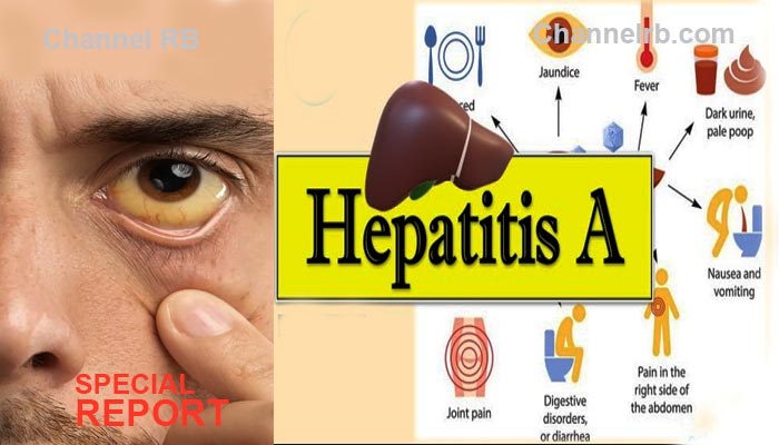 hepatitise-a