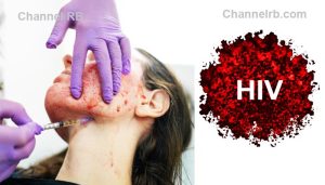 Read more about the article വാംപയര്‍ ഫേഷ്യല്‍ ചെയ്‌തവര്‍ക്ക് എച്ച്‌.ഐ.വി അണുബാധ; ഉറവിടം കണ്ടെത്താൻ അന്വേഷണം പുനഃരാംരംഭിച്ചു