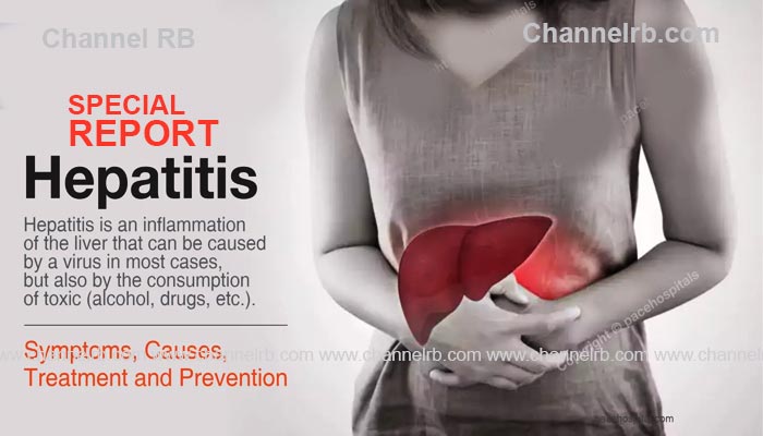 heppatitis-a