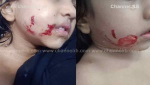 Read more about the article വീട്ടുവളപ്പിൽ കളിച്ചു കൊണ്ടിരുന്ന കുട്ടിക്ക് തെരുവ് നായയുടെ കടിയേറ്റു; കാസർകോട് കോട്ടക്കണിയിലാണ് സംഭവം