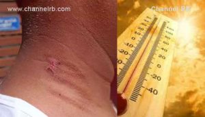 Read more about the article കാസര്‍കോട് ഒരാള്‍ മരണപെട്ടതിന് പിന്നാലെ സംസ്ഥാനത്ത് മുന്നുപേർക്കുകൂടി സൂര്യാഘാതമേറ്റു; ജനങ്ങൾ ജാഗ്രത പാലിക്കണം..