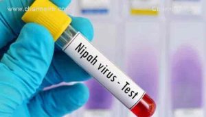 Read more about the article സംസ്ഥാനത്ത് വീണ്ടും നിപ സ്ഥിരീകരിച്ചു; ജഗ്രതയോടെ ആരോഗ്യവകുപ്പ്; സ്ഥിതിഗതികൾ വിലയിരുത്തി ആരോഗ്യ മന്ത്രിയും