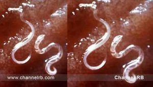 Read more about the article ജനുവരി 6 ദേശീയ വിര വിമുക്ത ദിനം; എല്ലാ സ്കൂളുകളിലും അങ്കണവാടികളിലും കുട്ടികൾക്ക് വിര നശീകരണത്തിനുള്ള ഗുളിക നൽകും; പ്രായം 1 മുതൽ 19; കൂടുതൽ അറിയാം..